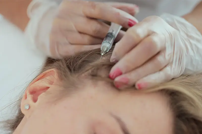 intradermoterapia